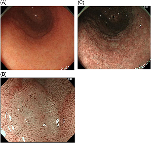 Details are in the caption following the image Details are in the caption following the image