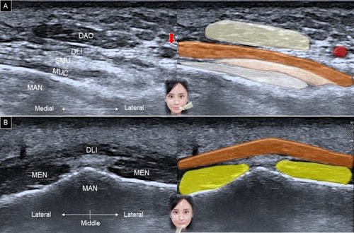 Details are in the caption following the image Details are in the caption following the image