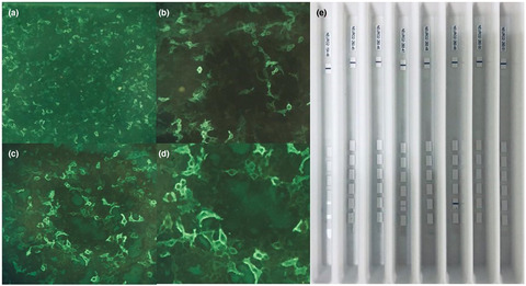 Limbic encephalitis associated with AMPA receptor and CRMP5 antibodies: A case report and literature review