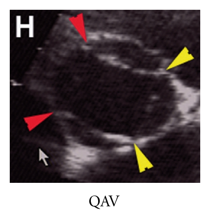 Details are in the caption following the image