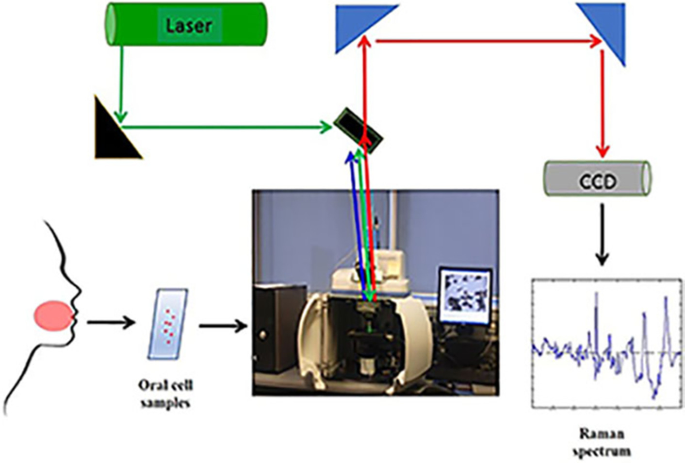 Raman microspectroscopic study for the detection of oral field cancerisation using brush biopsy samples