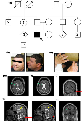 Details are in the caption following the image Details are in the caption following the image