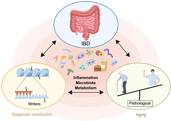 Role of epigenetic modifications and aging in inflammatory bowel disease