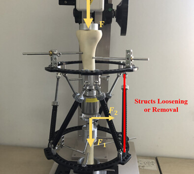 The Relation between the Dynamization of Hexapod Circular External Fixator and Tibial Mechanical Properties