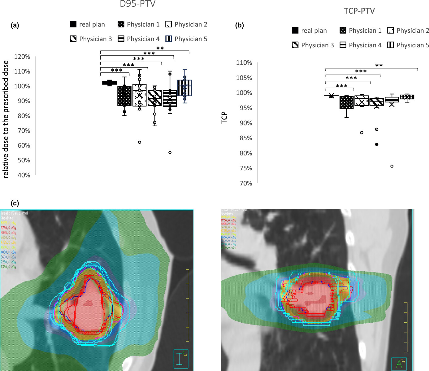 Clinical validation of a semi-automated segmentation algorithm for target volume definition on planning CT and CBCT in stereotactic body radiotherapy (SBRT) for peripheral lung lesions