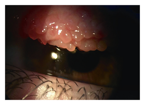 Details are in the caption following the image Details are in the caption following the image