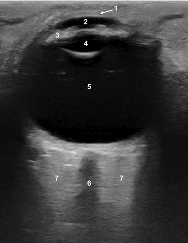 Details are in the caption following the image
