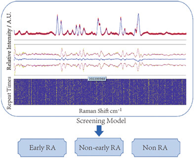 Serum Raman spectroscopy can be used to screen patients with early rheumatoid arthritis