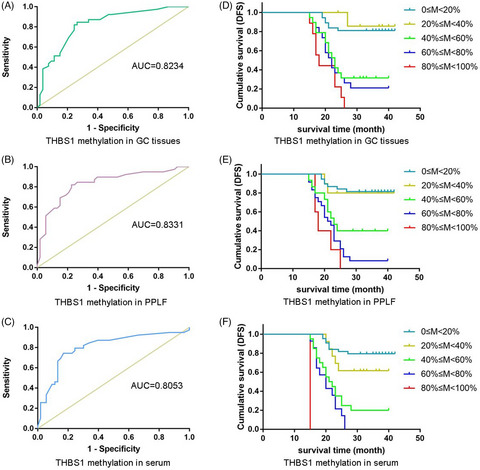 Circulating methylated THBS1 DNAs as a novel marker for predicting peritoneal dissemination in gastric cancer