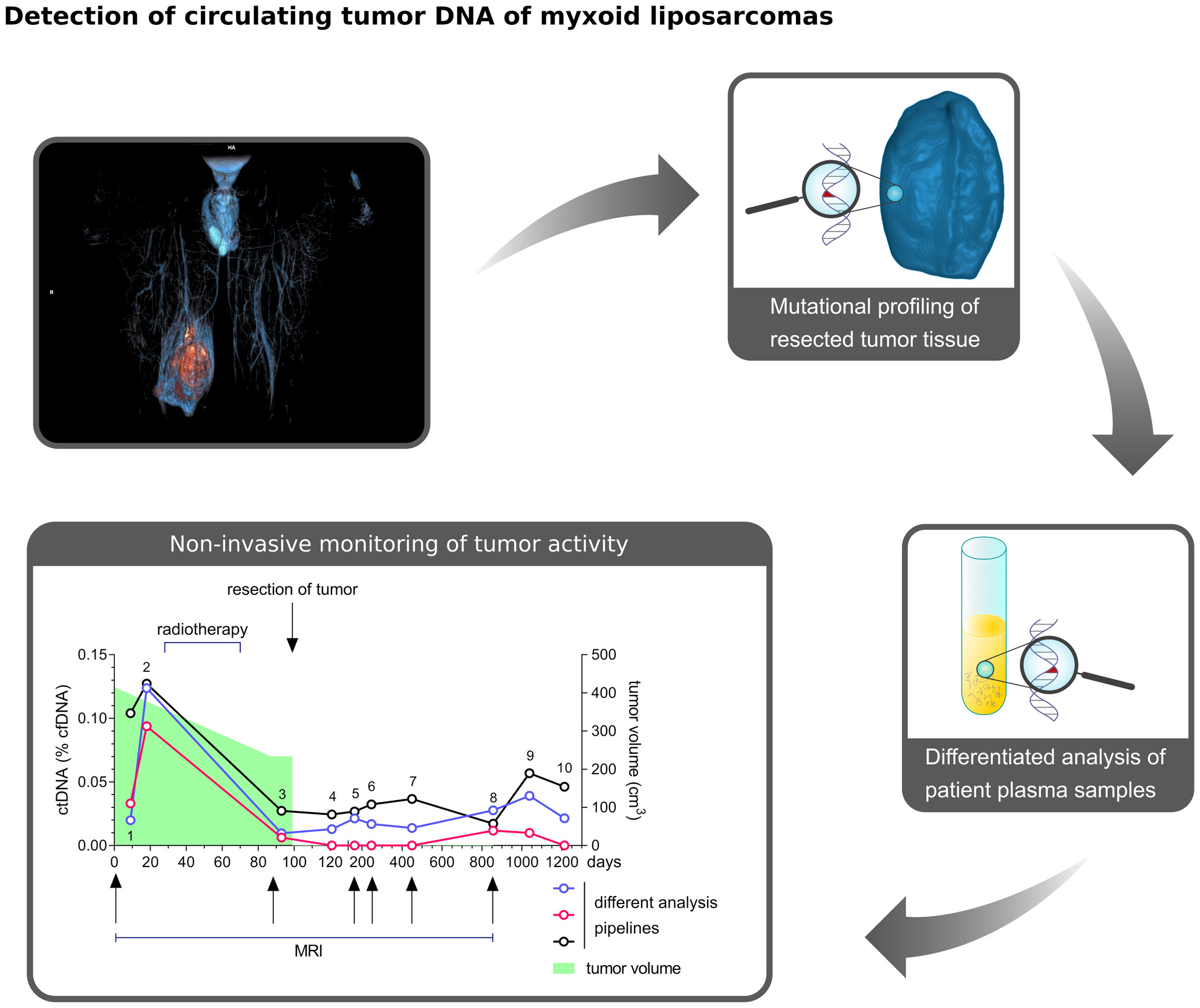 Improved Quantification of Circulating Tumor DNA in Translocation-Associated Myxoid Liposarcoma by Simultaneous Detection of Breakpoints and Single Nucleotide Variants