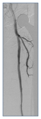 Details are in the caption following the image