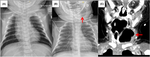 Details are in the caption following the image