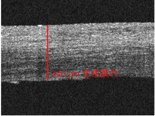 Details are in the caption following the image Details are in the caption following the image