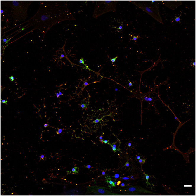 Ginsenoside Rg1 promotes astrocyte-to-neuron transdifferentiation in rat and its possible mechanism