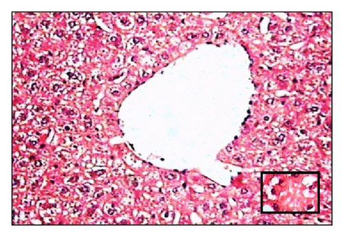 Details are in the caption following the image