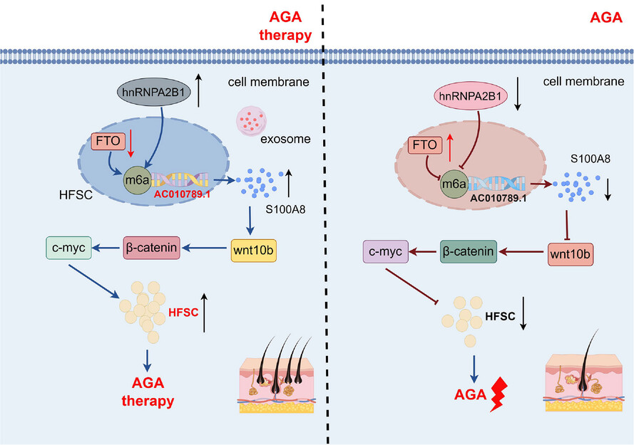Exosome-derived long non-coding RNA AC010789.1 modified by FTO and hnRNPA2B1 accelerates growth of hair follicle stem cells against androgen alopecia by activating S100A8/Wnt/β-catenin signalling