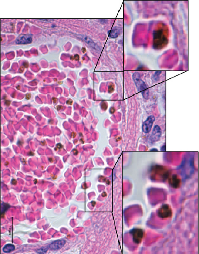 Details are in the caption following the image