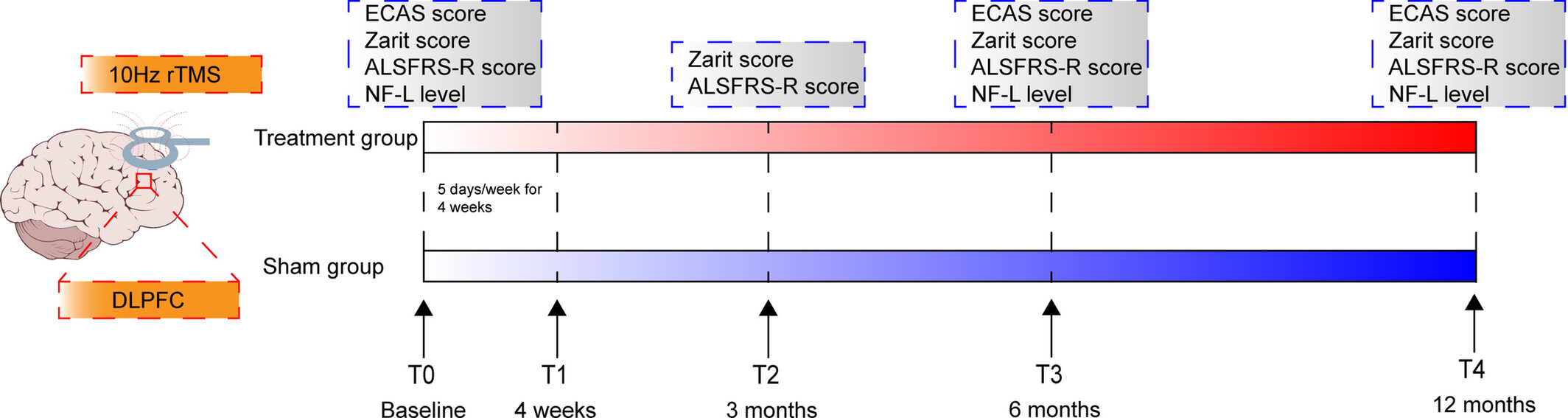 The Effect of Repetitive Transcranial Magnetic Stimulation of the Dorsolateral Prefrontal Cortex on the Amyotrophic Lateral Sclerosis Patients With Cognitive Impairment: A Double-Blinded, Randomized, and Sham Control Trial