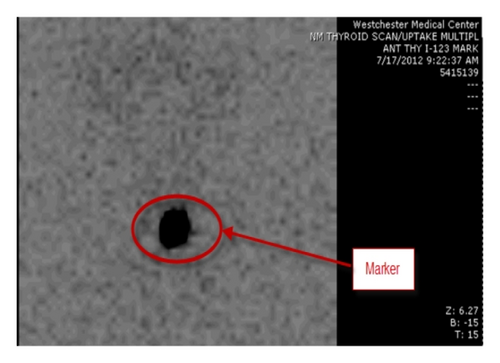 Details are in the caption following the image