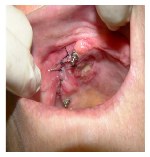 Details are in the caption following the image Details are in the caption following the image