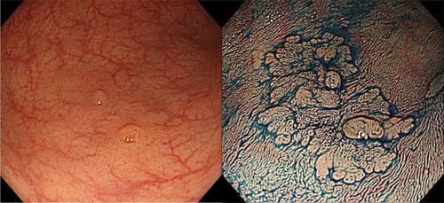 Details are in the caption following the image Details are in the caption following the image