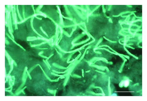 Details are in the caption following the image