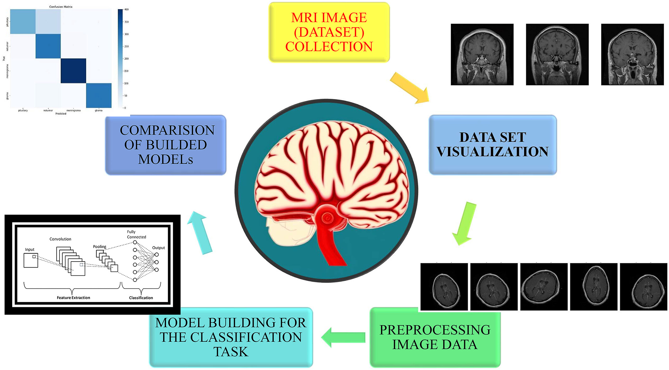 Advancing brain tumor diagnosis: Deep siamese convolutional neural network as a superior model for MRI classification