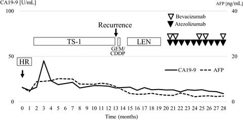 A case of unresectable combined hepatocellular and cholangiocarcinoma treated with atezolizumab plus bevacizumab