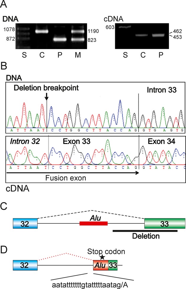 Alport syndrome caused by a COL4A5 deletion and exonization of an adjacent AluY