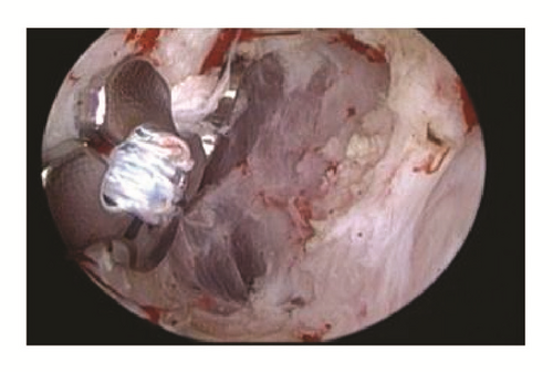 Details are in the caption following the image Details are in the caption following the image