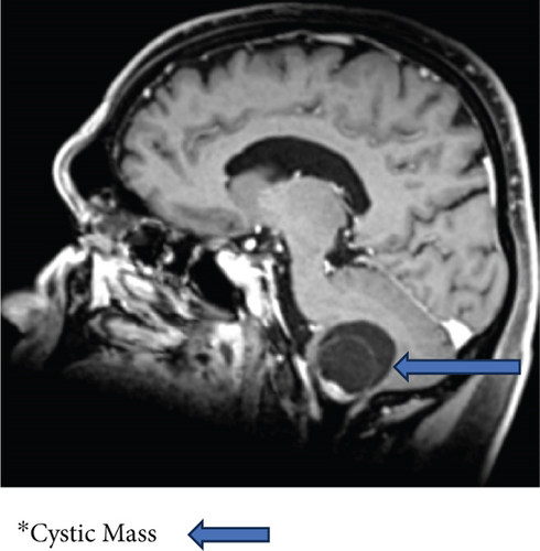 Details are in the caption following the image
