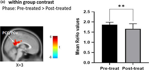 Changes in resting-state functional connectivity in nonacute sciatica with acupuncture modulation: A preliminary study