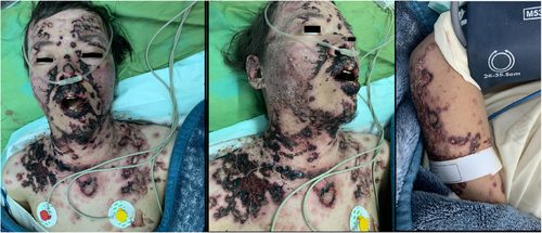 Details are in the caption following the image Details are in the caption following the image