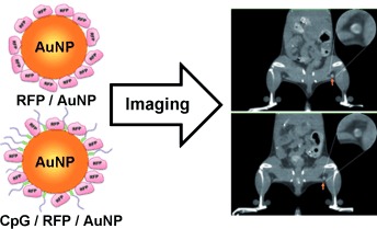 Imageable Antigen-Presenting Gold Nanoparticle Vaccines for Effective Cancer Immunotherapy In Vivo