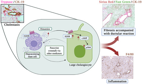 Mast cells selectively target large cholangiocytes during biliary injury via H2HR-mediated cAMP/pERK1/2 signaling