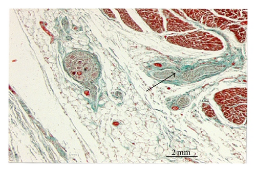 Details are in the caption following the image