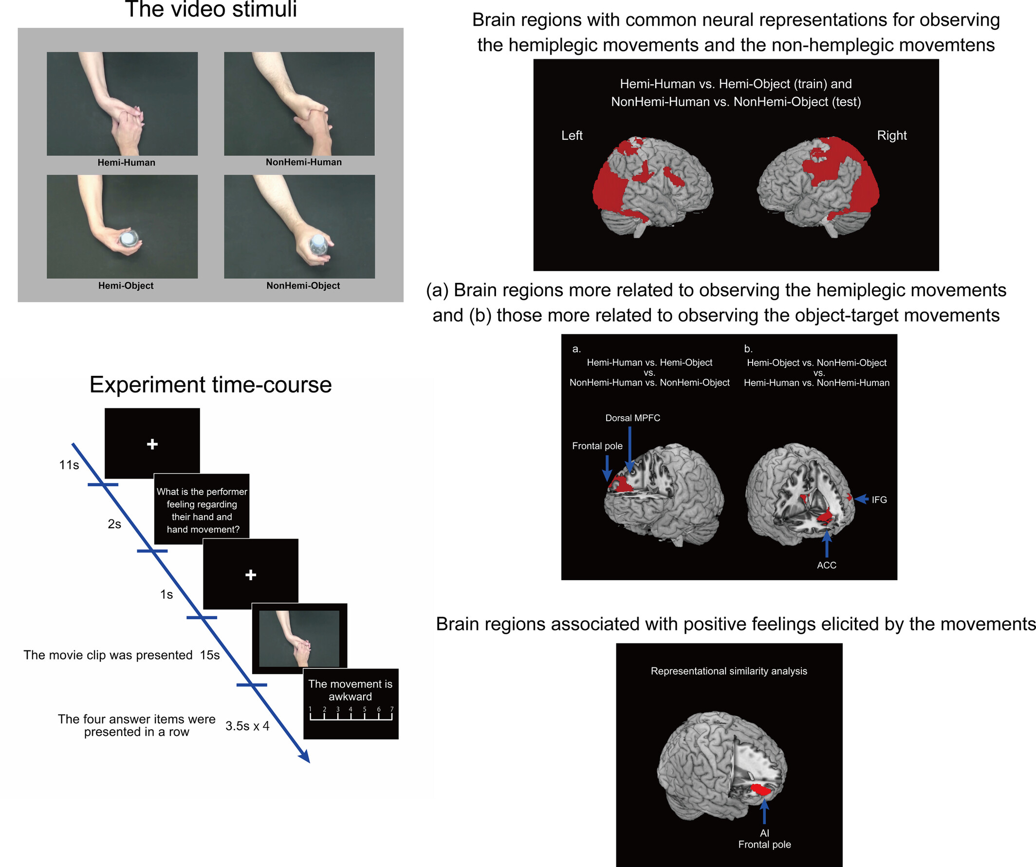 Understanding Empathy Toward Dissimilar Others in Challenging Everyday Interactions