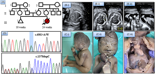 Details are in the caption following the image Details are in the caption following the image