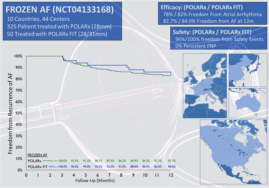One-year outcomes of pulmonary vein isolation with a novel cryoballoon: Primary results of the FROZEN AF trial