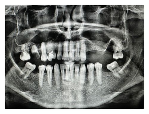 Details are in the caption following the image Details are in the caption following the image