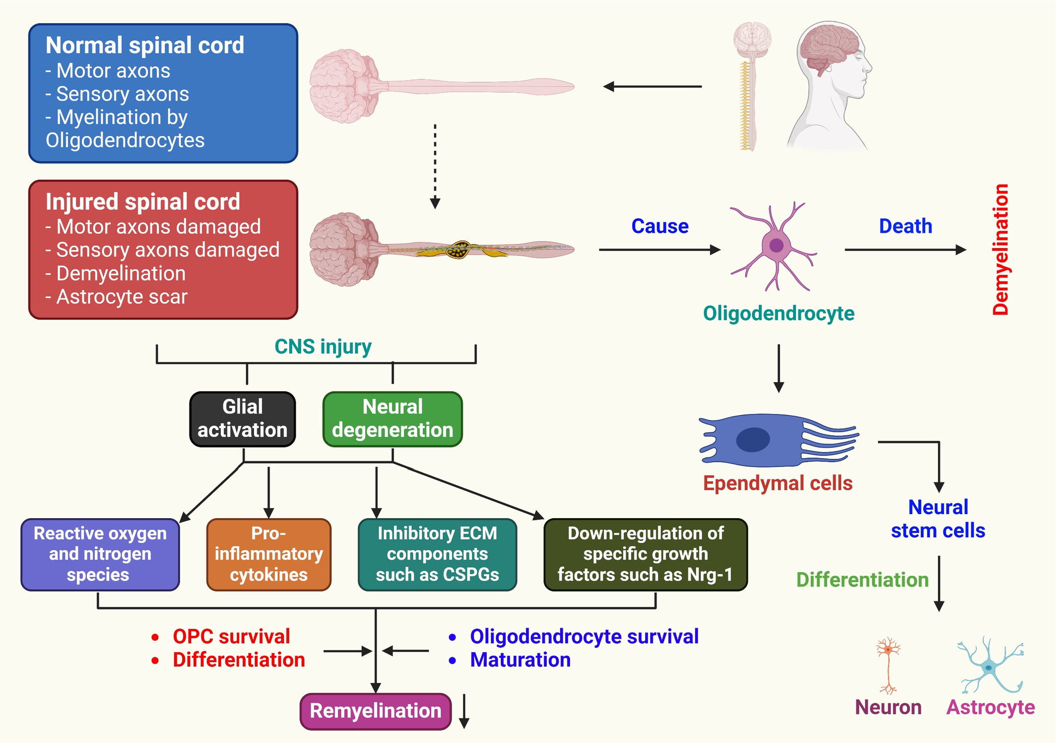 Targeting Remyelination in Spinal Cord Injury: Insights and Emerging Therapeutic Strategies