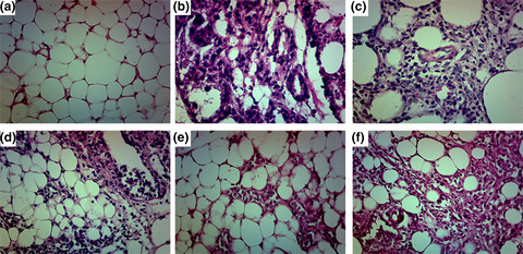 Infective mastitis due to bovine-associated Streptococcus dysgalactiae contributes to clinical persistent presentation in a murine mastitis model