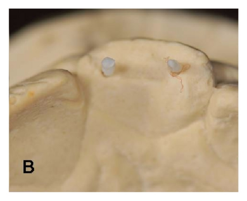 Details are in the caption following the image