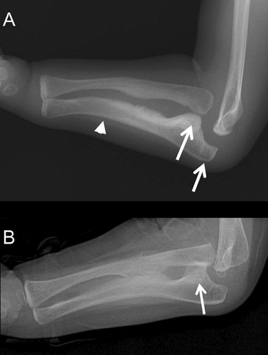 Details are in the caption following the image