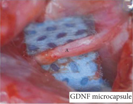 Details are in the caption following the image