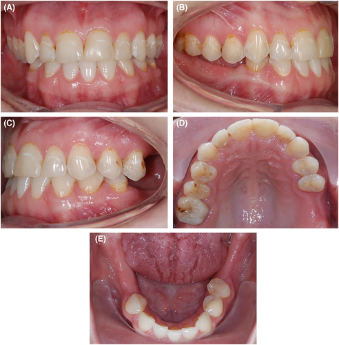Details are in the caption following the image Details are in the caption following the image