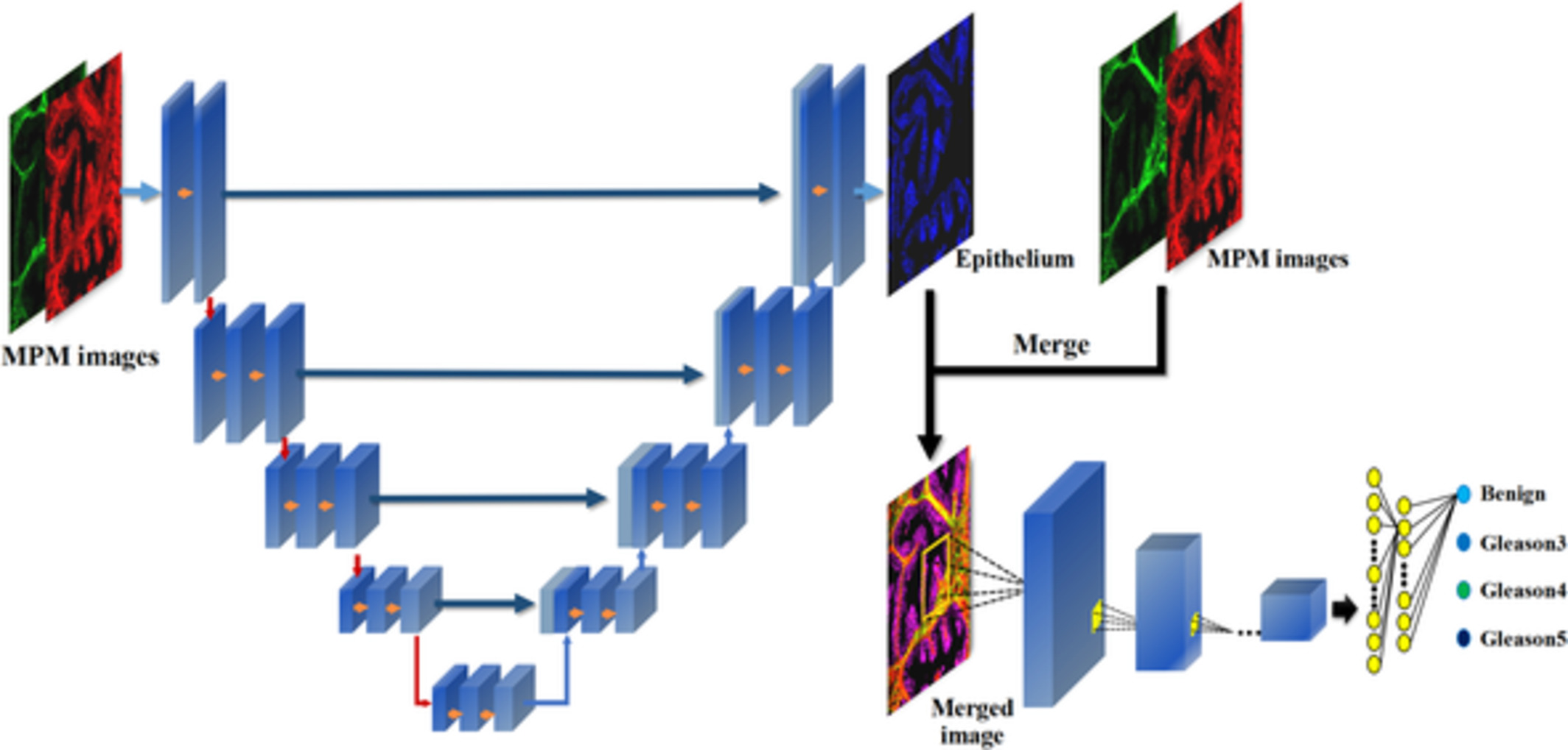 Epithelium segmentation and automated Gleason grading of prostate cancer via deep learning in label-free multiphoton microscopic images