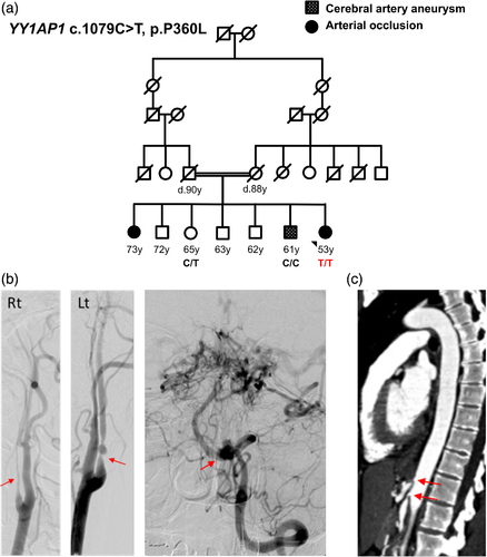 Details are in the caption following the image
