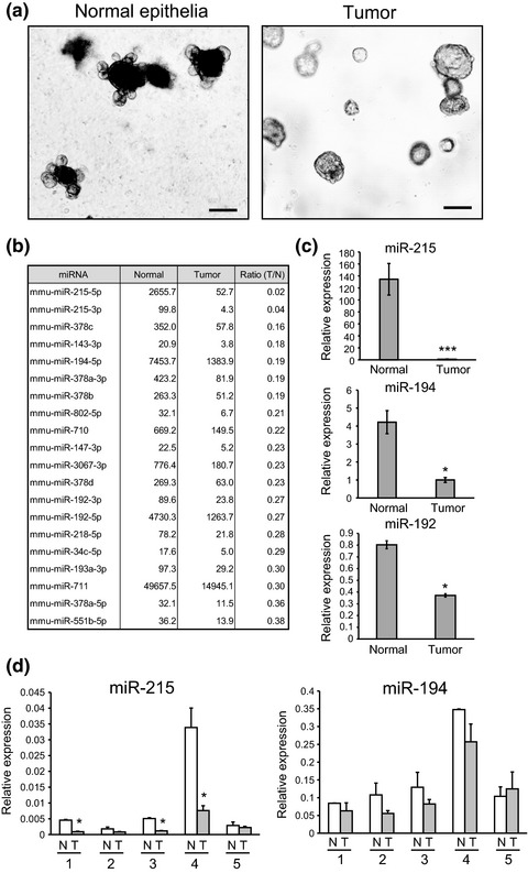 Cluster microRNAs miR-194 and miR-215 suppress the tumorigenicity of intestinal tumor organoids