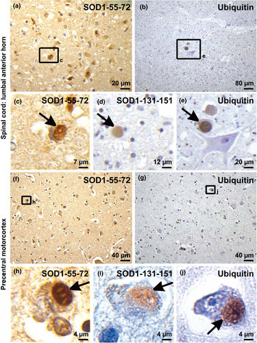 Details are in the caption following the image Details are in the caption following the image